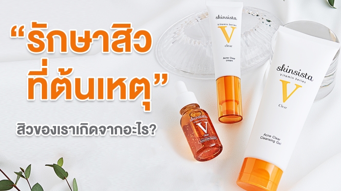 รักษาสิวที่ต้นเหตุ-มาเช็คดู-สิวของเราเกิดจากอะไร